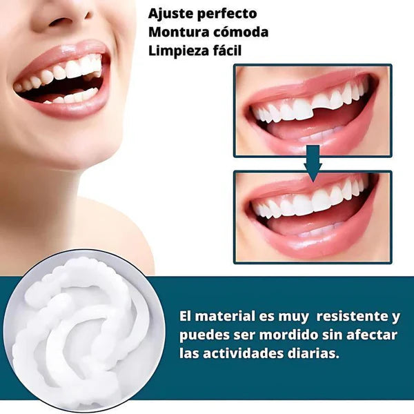 Carillas Dentales Removibles | Inferior y Superior 3
