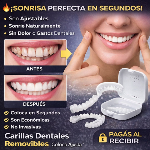 Carillas Dentales Removibles | Inferior y Superior