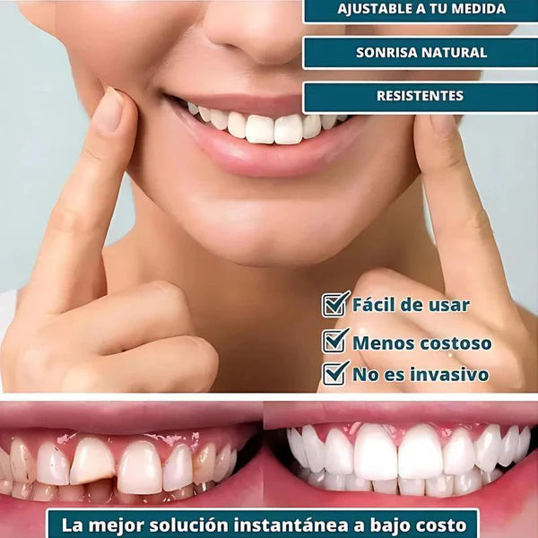 Carillas Dentales Removibles | Inferior y Superior 2