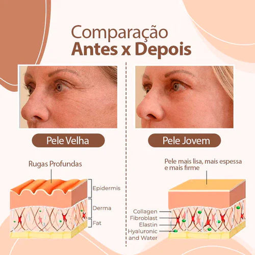 Compra 1 y llevate 2 O'Cheal - Bálsamo hidratante Anti-líneas de expresión - 2X1